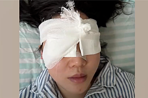 “右眼瞬间失明”!女游客高压水枪伤眼 如何应急处理