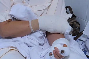 贵阳阿姨河道捡到漂亮石头 竟自燃导致自己四肢烧伤