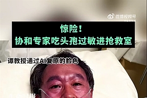 协和专家吃头孢遭抢救“不过敏 没喝酒”也中招 复盘写的4点教训需牢记
