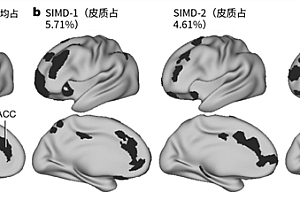 抑郁症病人的大脑到底发生了什么 真相惊人