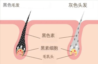 头发变白后能否重新变黑？医生揭示惊人真相！