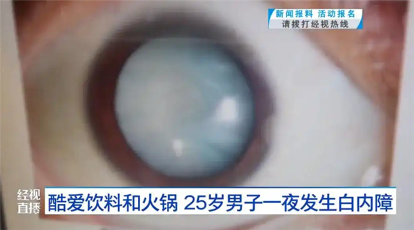 瞳孔中央全白了！武汉25岁男子一夜之间眼睛看不清