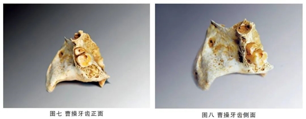 给曹操一盒布洛芬 能拯救他的头痛吗